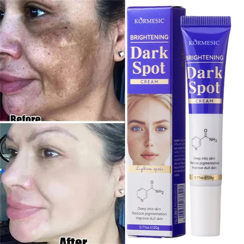 Dark Spots Removal Cream Facial Whitening Freckle Acne Mark Pigmentation Removal Melanin Skin Correction Brighten Care Products