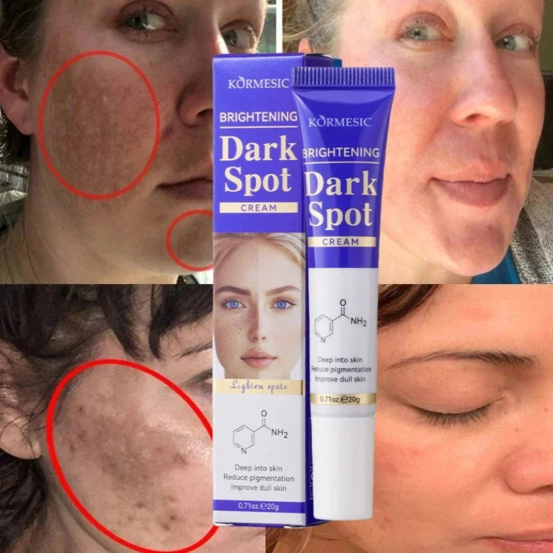 Dark Spots Removal Cream Facial Whitening Freckle Acne Mark Pigmentation Removal Melanin Skin Correction Brighten Care Products