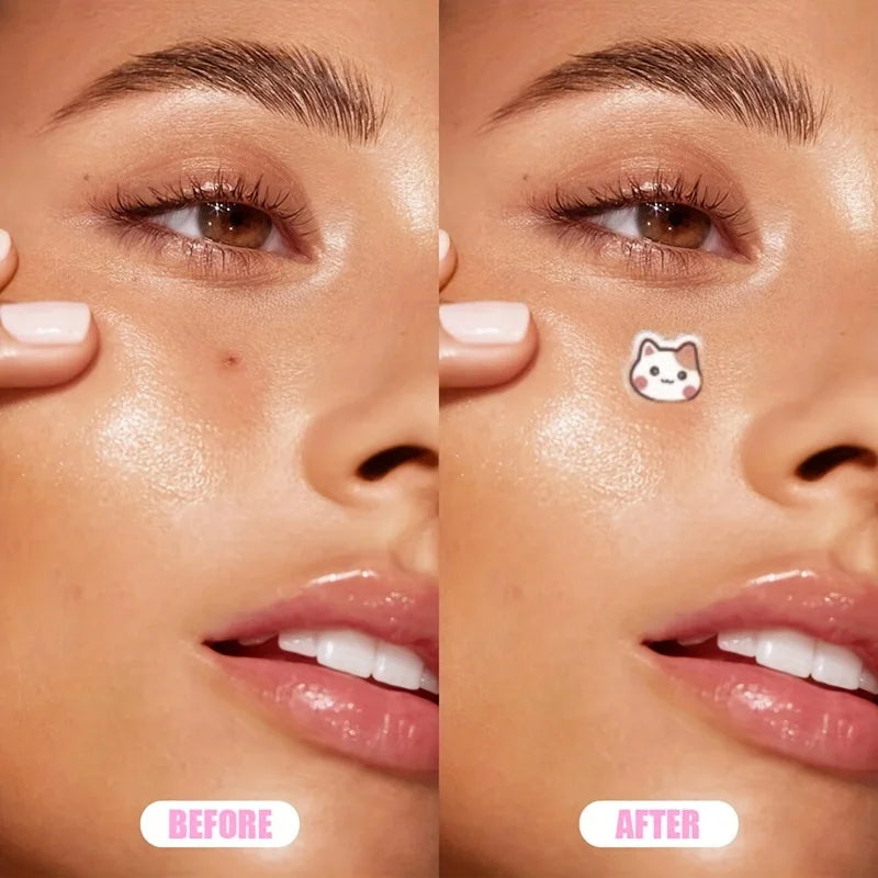12pcs Cute cartoon pimple patch, suitable for many occasions, skin gentle, waterproof, for both men and women