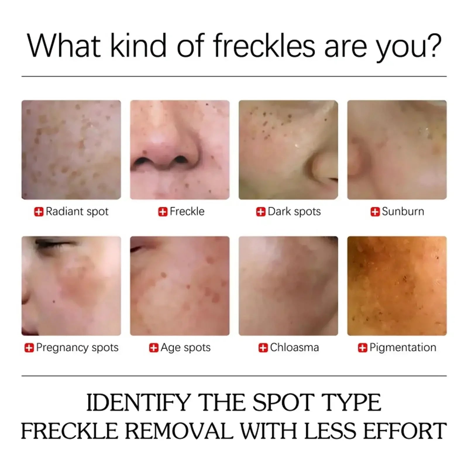 Dark Spots Removal Cream Facial Whitening Freckle Acne Mark Pigmentation Removal Melanin Skin Correction Brighten Care Products