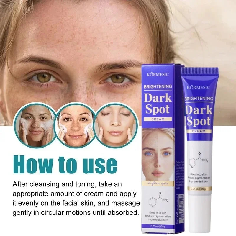 Dark Spots Removal Cream Facial Whitening Freckle Acne Mark Pigmentation Removal Melanin Skin Correction Brighten Care Products